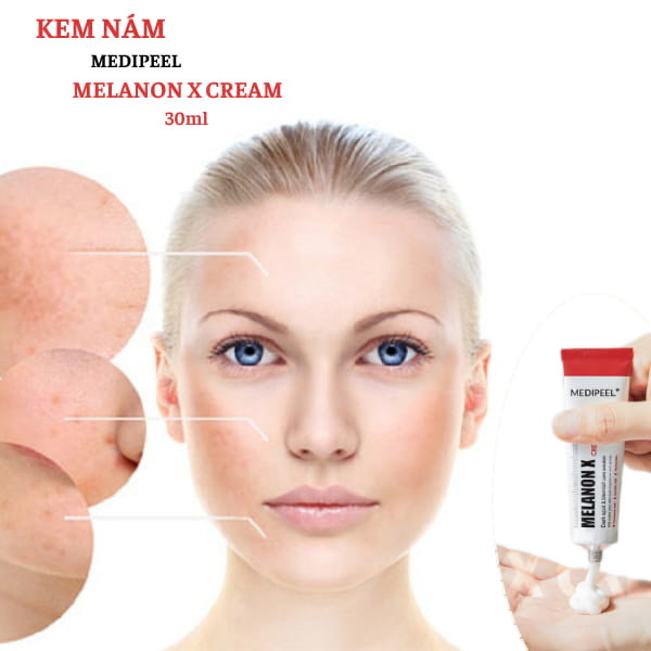 Kem dưỡng trị nám Medipeeel Melanon X Cream Kem dưỡng trị nám Medipeeel Melanon X Cream